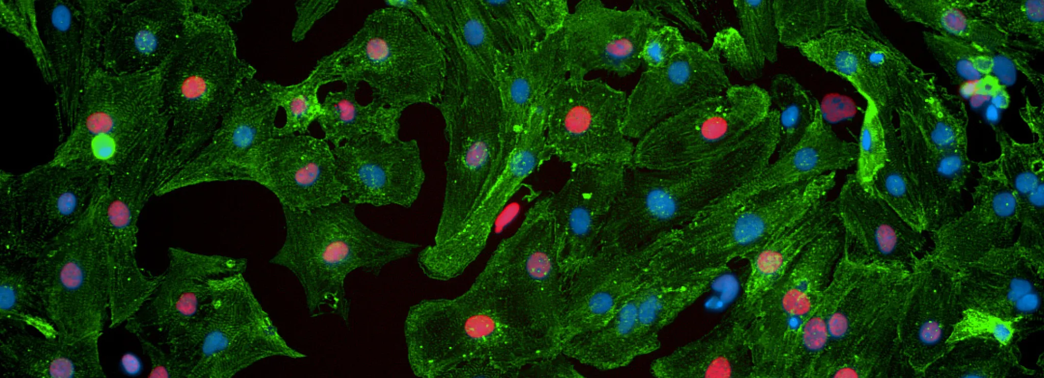 Fluorescent microscope image of heart cells.